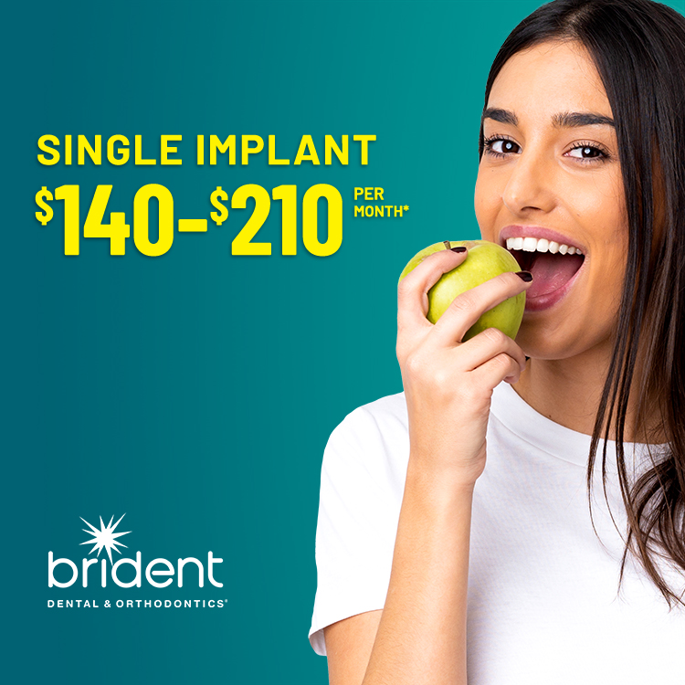 Single implant $140-210 per month*