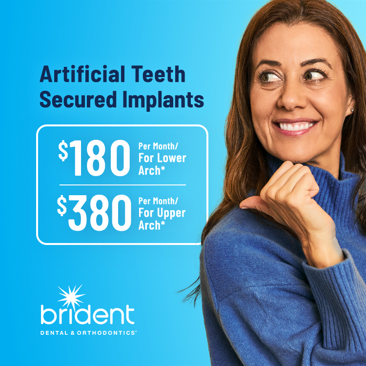 $180 per month for lower arch ($7,910 retail price)* $380 per month for upper arch ($9,040 retail price)*